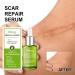 Goopgen Advanced Scar Repair Serum - Medical Grade Solution for Scar Removal on All Types of Scars - Buy Online on GoSupps.com