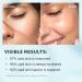 ZealSea Hyaluronic Acid Repair Serum for Dry Sensitive Skin Hydrating 1 Fl Oz | International Shipping Available - Buy Online on GoSupps.com
