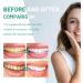 2PC Probiotics Whitening Teeth Mousse | Herbal Deep Cleaning Toothpaste for Fresh Breath & Gum Health - Buy Online on GoSupps.com
