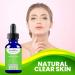 Tea Tree Serum Oil for Acne - 20% Vitamin C Hyaluronic Acid Retinol | Anti-Aging Dark Spots & Blemish Treatment | 2 Fl Oz (60 ml - Buy Online on GoSupps.com
