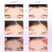 Forehead Wrinkle Patches - Anti-Wrinkle Pads for Men and Women (5 Pcs) - Buy Online on GoSupps.com