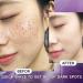 Dark Spot Remover for Face Spot Cream Dark Spot Corrector Skin Lightening Cream Pigmentation Removal Cream Dark Spot Correcting Glow Serum for Melasma Freckle Sun Spot Remover Blemish Reduction - Buy Online on GoSupps.com