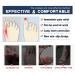 OBBOCK Bunion Corrector & Toe Separator for Women - Gel Toe Cushions - Prevent Rubbing & Relieve Pressure - Toe Protectors (4 Pack) - Buy Online on GoSupps.com