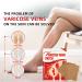 Spider Vein Plaster 30ct | Varicose Vein & Phlebitis Care | Leg Vein Removal Treatment - Buy Online on GoSupps.com