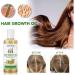 JITASHWA Hair Growth Oil Hair Growth Essence Repair Hair Follicles Hair Loss Prevention Hair Regrowth Treatment Hair Thickening Product - Buy Online on GoSupps.com