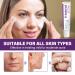 Buy Azelaic Acid Cream & 12% Serum - Skin Hyaluronic Acid & Niacinamide for Redness Relief - Fast International Shipping - Buy Online on GoSupps.com