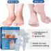 NPkgvia Gel Big Toe Bunion Guard & Protector | Toe Splitter Bunion Pad Corrector for Bent Toes Pressure | White One Size - Buy Online on GoSupps.com