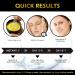 24K Gold Under Eye Masks - Collagen Patches for Dark Circles, Puffiness & Anti-Wrinkle - 30 Pairs - Buy Online on GoSupps.com