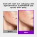 GLAM UP 10% Sulfur Treatment Spot Serum for Acne & Blemishes - Fast Healing Overnight Solution | 15mL Made in USA - Buy Online on GoSupps.com