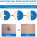 Skin Tag & Mole Remover Kit - Safe & Painless Removal for Small to Large Skin Tags (2mm-8mm) - Buy Online on GoSupps.com