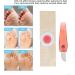 Toe Corn Remover Stickers - Soft Breathable Foot Pads for Effective Home Treatment | Sufficient Quantity for Comfort & Relief - Buy Online on GoSupps.com