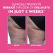 Peter Thomas Roth | FIRMx Tight & Toned Cellulite Treatment Body Cream Clinically Proven to Reduce the Look of Cellulite In Just 2 Weeks - Buy Online on GoSupps.com
