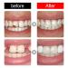 Temporary Tooth Caps & Crowns - Dental Repair Veneers for Front & Molar Teeth | 100 Pieces - Buy Online on GoSupps.com