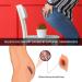 Jopwkuin Hemorrhoid Plaster Patch 30PCS - Skin-Friendly Ointment for External Discomfort - Buy Online on GoSupps.com
