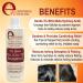 Folliculitis Treatment Set with Salicylic Acid | Shampoo Serum & Spray for Oily Scalp Dandruff & Flaky Skin - International Shipping - Buy Online on GoSupps.com