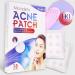 pimple patches for face with Tea Tree Oil & Salicylic Acid Scar Hydrocolloid Acne Patches Spot Treatment Pimple Patches Microdart 7x Absorbency Deep Blemish Microdarts for Face & Neck