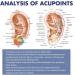 Facial Reflex Zone Massage Tools | Acupuncture Ear Seeds & Kits | Acupressure Solutions - Buy Online on GoSupps.com