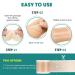 Silicone Scar Sheets & Tape (1.6 x 120 Roll-3M) for Surgical Scars, Keloid, C-Section, Burn, Acne - Reusable & Professional Scar Removal Strips - Buy Online on GoSupps.com