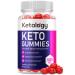 Ketology Keto Gummies Ketology Keto ACV Gummies Ketology ACV Keto Gummies with 1000mg Apple Cider Vinegar Vitamin B12 Vitamin B6 Beet Root Juice Ketology Gummies Pomegranate Juice (60 Gummies)