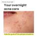 TIAM Surprise B Hydrocolloid Acne Pimple Patch - 96 Count (Pack of 4) | Fast Shipping Worldwide - Buy Online on GoSupps.com