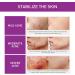  BEROZA Set of 3 creams for facial blemishes creams to remove facial blemishes whitening cream for freckles eliminates melasma and dark spots lightens skin - Buy Online on GoSupps.com