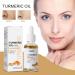 Turmeric Serum Turmeric Serum for Dark Spots Remover Turmeric Dark Spots Corrector Serum Oil for Face & Body Whitening Heals Scars Natural Whitening Serum Care Skin Care - Buy Online on GoSupps.com