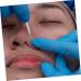 Outanaya Cleaning Tools 7pcs Tools Facial Cleaning Pore Extractor Comedone Pimple Removers Mixed Comedone Extractor - Buy Online on GoSupps.com