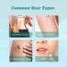 MAITING Scar Remove Advance Spray - Effective Solution for All Types of Scars - Buy Online on GoSupps.com