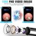 Ear Wax Removal Tool Burdee Ear Cleaner with Scope Camera 1080P FHD Portable Wireless Visual Ear Otoscope Pen Compatible with iPhone Android Smart Phones Suitable for Kids Adults - Buy Online on GoSupps.com
