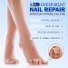 21 Patches Multi-Purpose Toenail Repair Treatment Pads Fungal Nail Patches Fungal Nail Treatment for Toenails Nail Repair for Damaged Nails Ingrown Toenail Treatment Fungal Nail Treatment Extra Strong - Buy Online on GoSupps.com