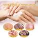 Hand Cream Set Intense Repairing Hand Cream 20g Ice Hand Cream Fruity Hand Cream Mini Hand Creams - Relieves Repairs & Hydrates - Very Dry Skin - Buy Online on GoSupps.com