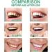 Bodyexcel Dentifrice dentifrice Tribright p te dentaire Bodyexcel Niacinamide dentifrice Bodyexcel dentifrices Ascart Radiant (2) - Buy Online on GoSupps.com