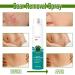 Heal Scar Care Spray | Advanced Formula for All Scar Types | 80g - Enhance Healing & Reduce Visibility - Buy Online on GoSupps.com