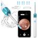 QDCFY Otoscope Ear Camera 1080P HD 3.5mm Ear Cleaning Tool for IOS and Android Smartphones (White) White