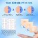 Ultimate Skin Tag Remover Kit | Fast & Effective Warten Removal Tool for Fibroma & Wart Treatment | 60 Skin Tags (1mm-8mm) - International Shipping Available - Buy Online on GoSupps.com