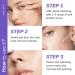 Niacinamide Serum With Fruit Acid Korean Serum Reduces Redness Hydrating Serum Improve Blemishes Dark Spot Correcting Glow Serum Brightening Serum For All Skin Type Serums Skincare - Buy Online on GoSupps.com