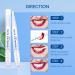 Teeth Whitening Pen Set - 3 Packs | Effective, Painless, Travel-Friendly, 35% Carbamide Peroxide | Natural Mint, No Sensitivity for Sensitive Teeth - Buy Online on GoSupps.com