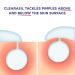 Clearasil Rapid Rescue Benzoyl Peroxide Spot Treatment Cream - Acne Relief in 4 Hours - 1oz - Buy Online on GoSupps.com