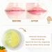 ANAIRUI Lip Therapy Set - Turmeric Honey Lip Care Kit for Fuller, Softer Lips - Buy Online on GoSupps.com