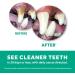 Fresh Breath TropiClean Mouth Care Gel for Dogs & Cats - Brushless Plaque & Tartar Removal - Advanced Whitening - 118ml - Buy Online on GoSupps.com