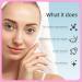 EFLY Hydrocolloid Pimple Patches with Tea Tree Oil & Salicylic Acid Invisible Acne Dots for Face 210 Patches - Buy Online on GoSupps.com