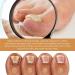 Cuticle Remover Gel 30ML Gentle Nail Care Cream for Softening and Moisturizing Cuticles - Buy Online on GoSupps.com