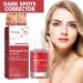 Tongyend Dark Spot Serum Brightening Serum Niacinamide Serum Faded Cream For Dark Spots Dark Spot Corrector For Face Age Spot Remover For Face Face Redness Remover Arbutin Serum Acne Scar 30ml - Buy Online on GoSupps.com
