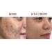 Turmeric Scar Red Cream + Nano Vitamin C Serum Combo - Restore Skin Radiance and Fade Scars, Dark Spots, and Dullness - Buy Online on GoSupps.com