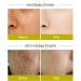 Turmeric Serum For Dark Spots 40Ml Anti-Aging Brighten Skin Turmeric Serum For Face Freckle Removal Skin Rejuvenating Moisturize Even Skin Tone Turmeric Dark Spot Corrector Serum For All Skin Types - Buy Online on GoSupps.com