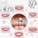 Temporary Tooth Repair Kit - Moldable Fake Teeth & Thermal Fitting Beads for Quick Tooth Replacement | White Teeth Repair Solution - Buy Online on GoSupps.com