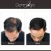 Buy Extra Strength Hair Growth Shampoo - DHT Blocker for Men & Women | Stimulates Follicle Regrowth Thicker Stronger Healthier Hair - No Side Effects - Buy Online on GoSupps.com