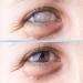 Moisturizing Eye Drops for Cataract & Glaucoma | Antioxidant Eye Drops for Dry Eyes (30 Pieces/3 Boxes) - International Shipping - Buy Online on GoSupps.com