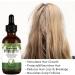 Rosemary Essential Oil for Hair Growth-60ML Rosemary Oil 100% Pure Hair Care Essential Oil Strengthens Hair Roots and Nourishes the Scalp for Women&Men - Buy Online on GoSupps.com