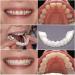 Giural Cosmetic Tooth Instant Veneers | Snap-On Teeth & Simulation Braces for a Beautiful Smile - Reusable & Removable (2 Pairs) - Buy Online on GoSupps.com